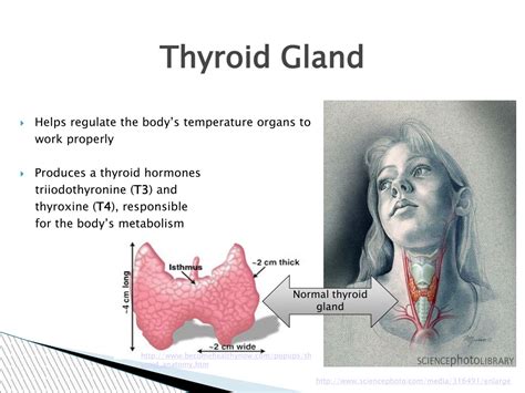 Ppt Thyroid Diseases And Their Pharmacological Treatment Powerpoint