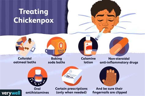 Overview Of Treatments For Chickenpox