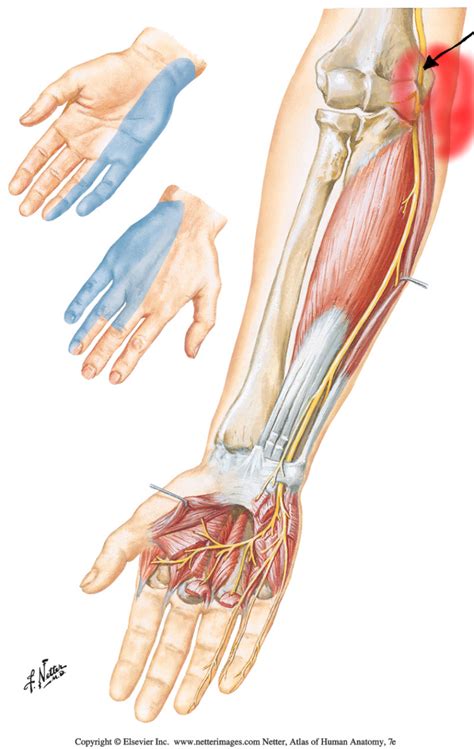 Cubital Tunnel Syndrome Anatomy Images And Photos Finder