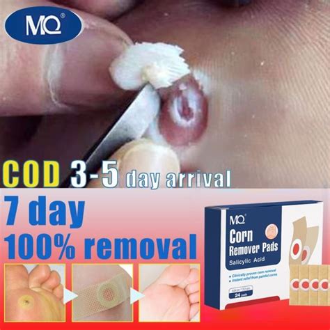 new 2023 24pcs foot corns remover patch remove calluses on the feet