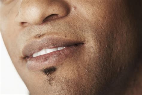 What Your Lips Reveal About Your Health Blackdoctor