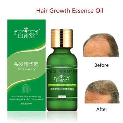 🧡 hair fiber is soft to the touch. Hair Growth Essential Oils Original Authentic Hair Loss ...