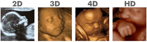 hd ultrasound pricing 3d ultrasound packages clearview ultrasound