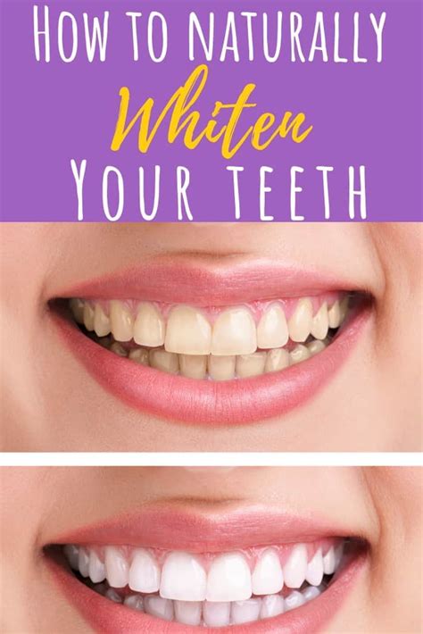 Teeth Treat What Are The Dangers Of Teeth Whitening