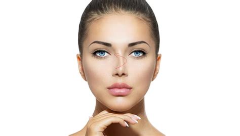 Ulvi güner, sizi çok kısa bir sürede istediğiniz görüntüye kavuşturacak ameliyatsız burun estetiği yöntemlerini anlattı. Deviasyon Nedir? Deviasyon Ameliyatı ve Sonrası | Prof. Dr ...