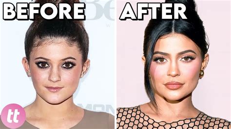 Celebrities Before And After Plastic Surgery Youtube
