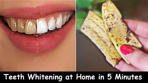 Teeth Whitening At Home Whiten Yellow Teeth And Remove Plaque