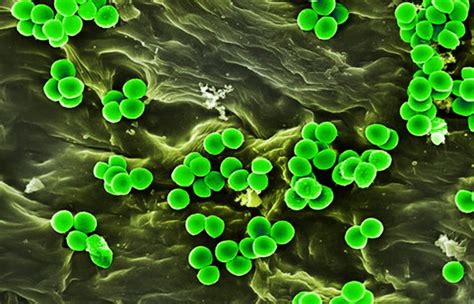 Diferencias Entre Endotoxina Y Enterotoxina Sooluciona