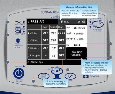 What is a ventilator and who needs one? NURSING CARE OF PATIENT ON VENTILATOR - Nursing Manthra