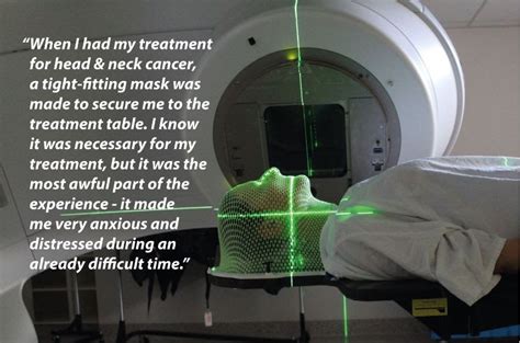 Radiation Therapy For Head And Neck Cancer All About Radiation