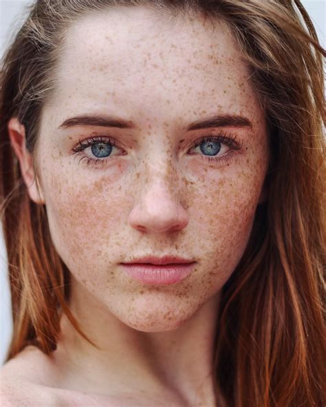Truly Captivating Beautiful Freckles Freckles Girl