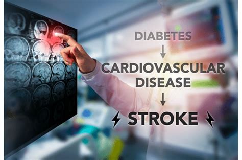 Diabetes Cardiovascular Disease And Stroke Life Line Screening