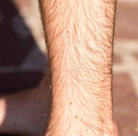 Hair On The Legs Of A Man Stock Image Image Of Body 106027209