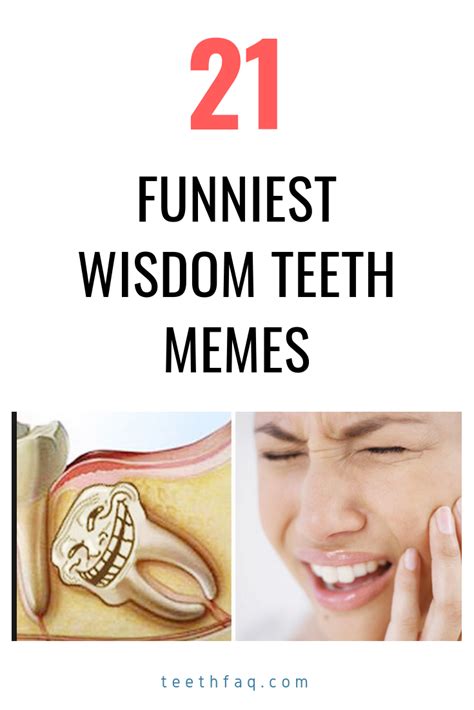 The 21 Funniest And Best Wisdom Teeth Memes To Share With Someone After