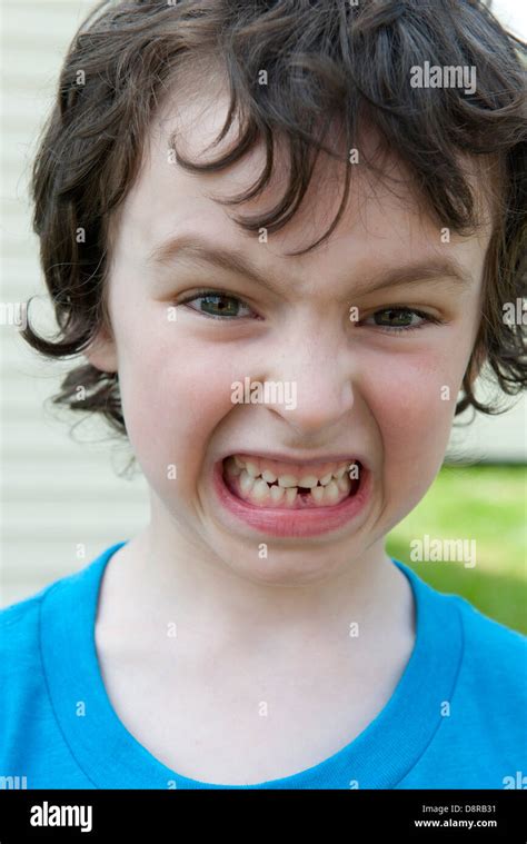 Junge Grimassieren Zeigt Fehlenden Zahn Porträt Stockfotografie Alamy