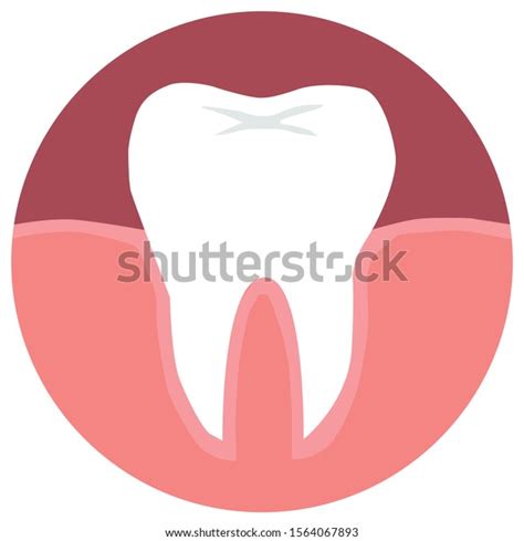 Tooth Gums Inflammation Flat Vector Illustration Stock Vector Royalty