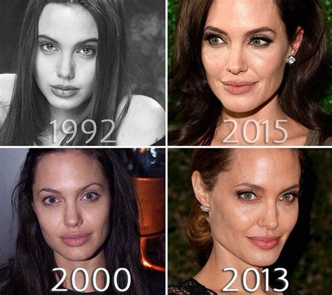 Angelina Jolie Face Before And After Photo Angelina Jolie Plastic