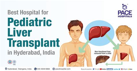 Best Hospital For Pediatric Liver Transplant In Hyderabad India
