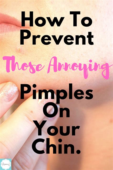 How To Prevent Pimples On Your Chin Gorgeouz Corrective Skincare
