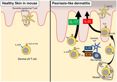Ijms Free Full Text Role Of Innate Immune Cells In Psoriasis