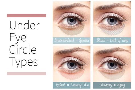 What S Your Under Eye Circle Type Youbeauty Com Beauty Skin Care Undereye Circles Beauty