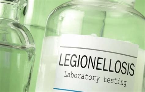 Legionella Water Sampling And Testing Services Water Hygiene Services