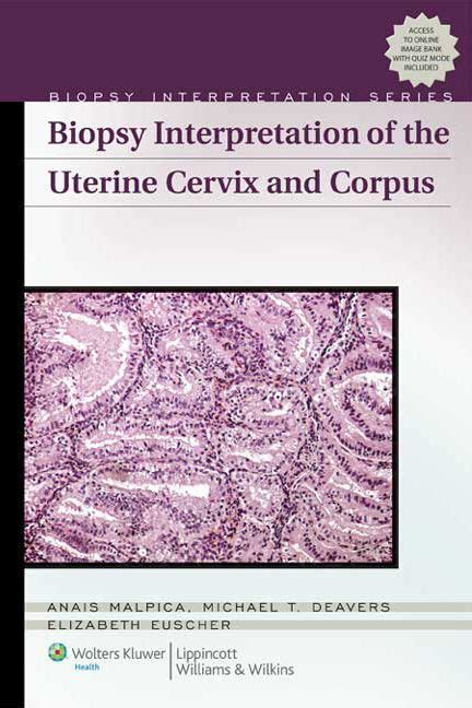 Biopsy Interpretation Of The Uterine Cervix And Corpus By Anaïs Malpica