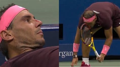 Rafael Nadal Hits Nose By Own Racket Blood Pours Out Beats Fabio