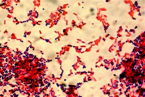 This is important since bacteria often experience variations in. Gram Positive vs. Gram Negative Bacteria