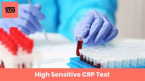 Generally, there are low levels of crp detectable in the blood. High Sensitive CRP (hsCRP): Purpose & Normal Range of ...