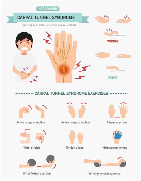 4 Signs And Symptoms Of Carpal Tunnel Syndrome
