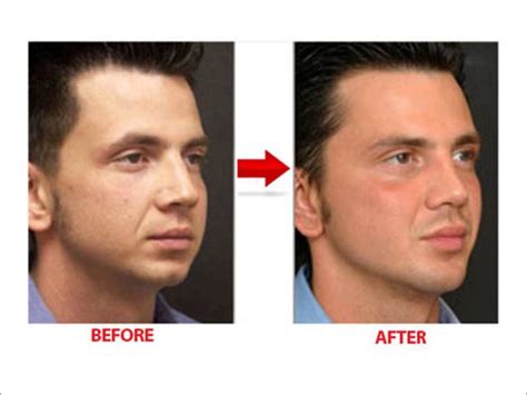 Losing face excess fat and also double face is no very easy activity and. How To Lose Face Fat Fast - Get Rid Of Cheek Fat Tips ...