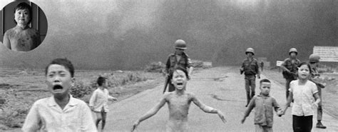 Napalm Girl The Vietnam War Tragedy And Her Life Story After The War