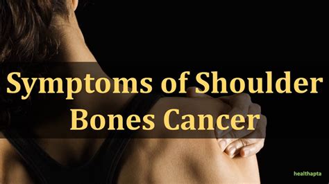Symptoms Of Shoulder Bones Cancer YouTube