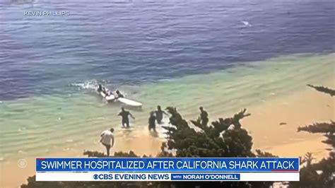 It Spit Me Out Man Recounts Great White Shark Attack