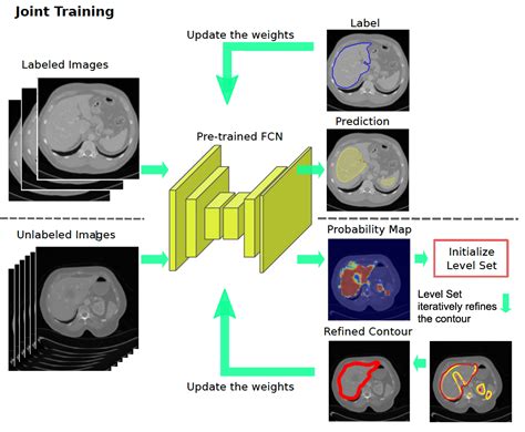 Deep Learning For Medical Image Segmentation Vrogue