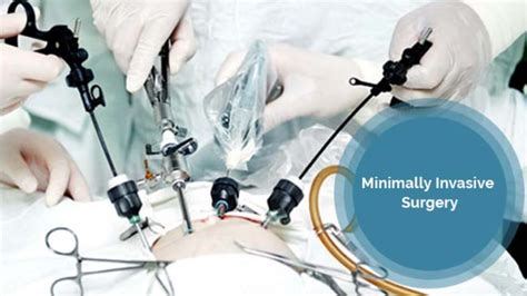 Avantages De La Chirurgie Mini Invasive