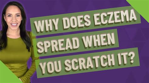 Why Does Eczema Spread When You Scratch It Youtube