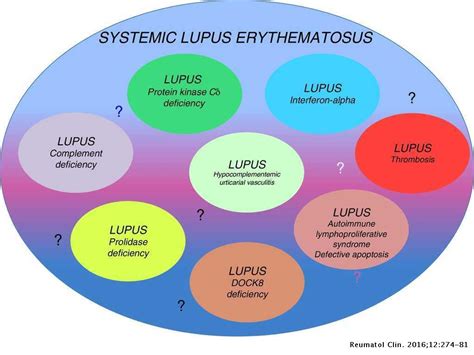 Systemic Lupus Erythematosus Sle Risk Factors Treatment Options And