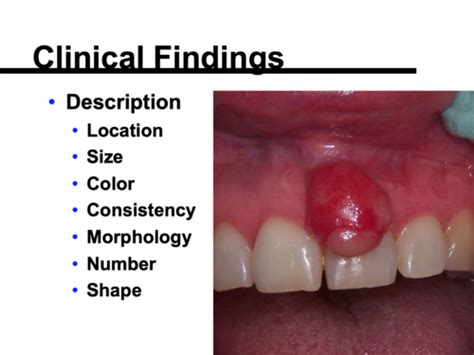 Lesson 1 Pathology Nomenclature How To Describe Oral Lesions Flashcards Quizlet