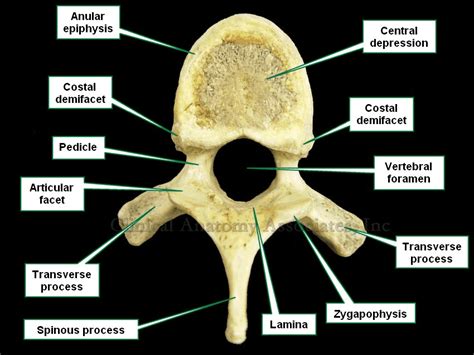 Lumbar Vertebrae Vertebral Arch