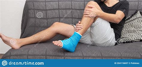 Man With Broken Leg In Blue Splint For Treatment Of Injuries From Ankle