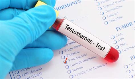 How To Lower Testosterone Levels In Women Reproductive Health Tech Project