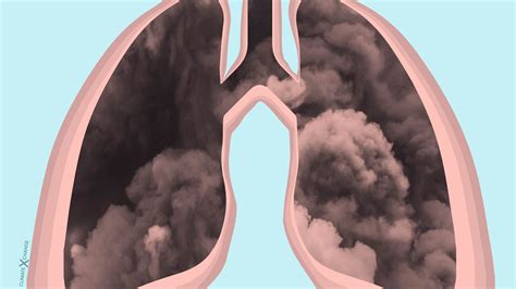Air Pollution Effects On Respiratory System