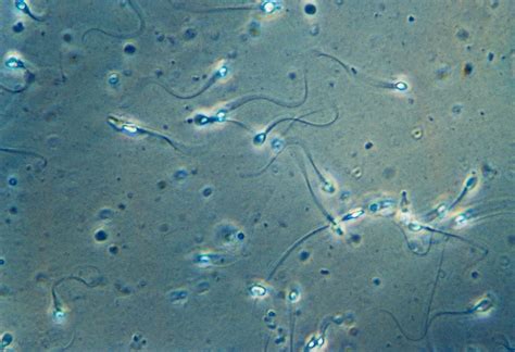 Opinion Your Sperm Is In Trouble The Washington Post