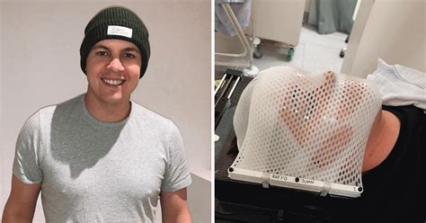 Johnny Ruffo Shares Radiation Treatment Update Amid Second Brain Cancer Battle 9celebrity