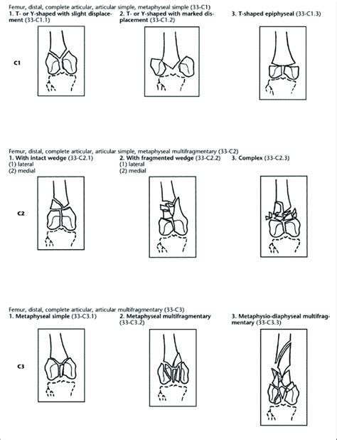 Aoota Classification Of Distal Femur Type C Fractures Download