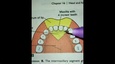 Development Of Hard Palate Youtube