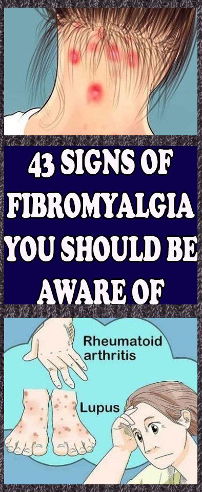 43 Signs Of Fibromyalgia You Should Be Aware Of
