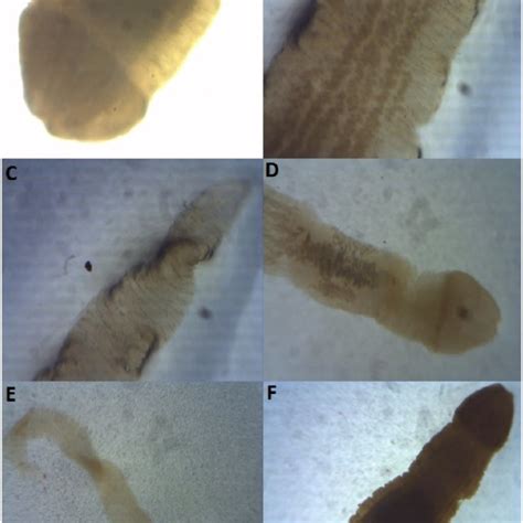 Pathological Effects Of Helminth Parasites On C Nigrodigitatus A